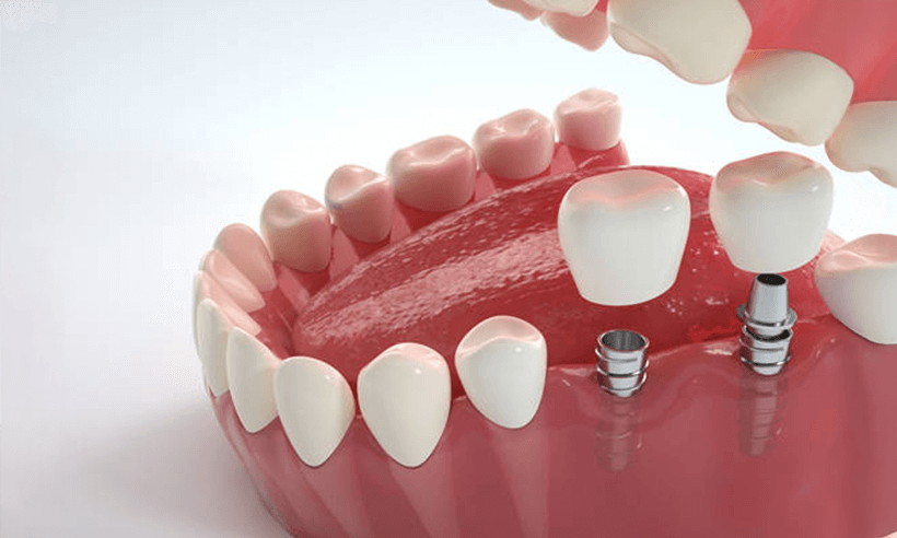 Deep Clean a Greasy Range Hood